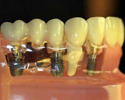 Dental Biomaterials.jpg