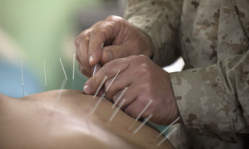 800px-Flickr_-_Official_U.S._Navy_Imagery_-_Cmdr._Yevsey_Goldberg_conducts_an_acupuncture_procedure..jpg