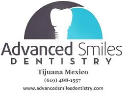 Cheap Dental Work in Mexico