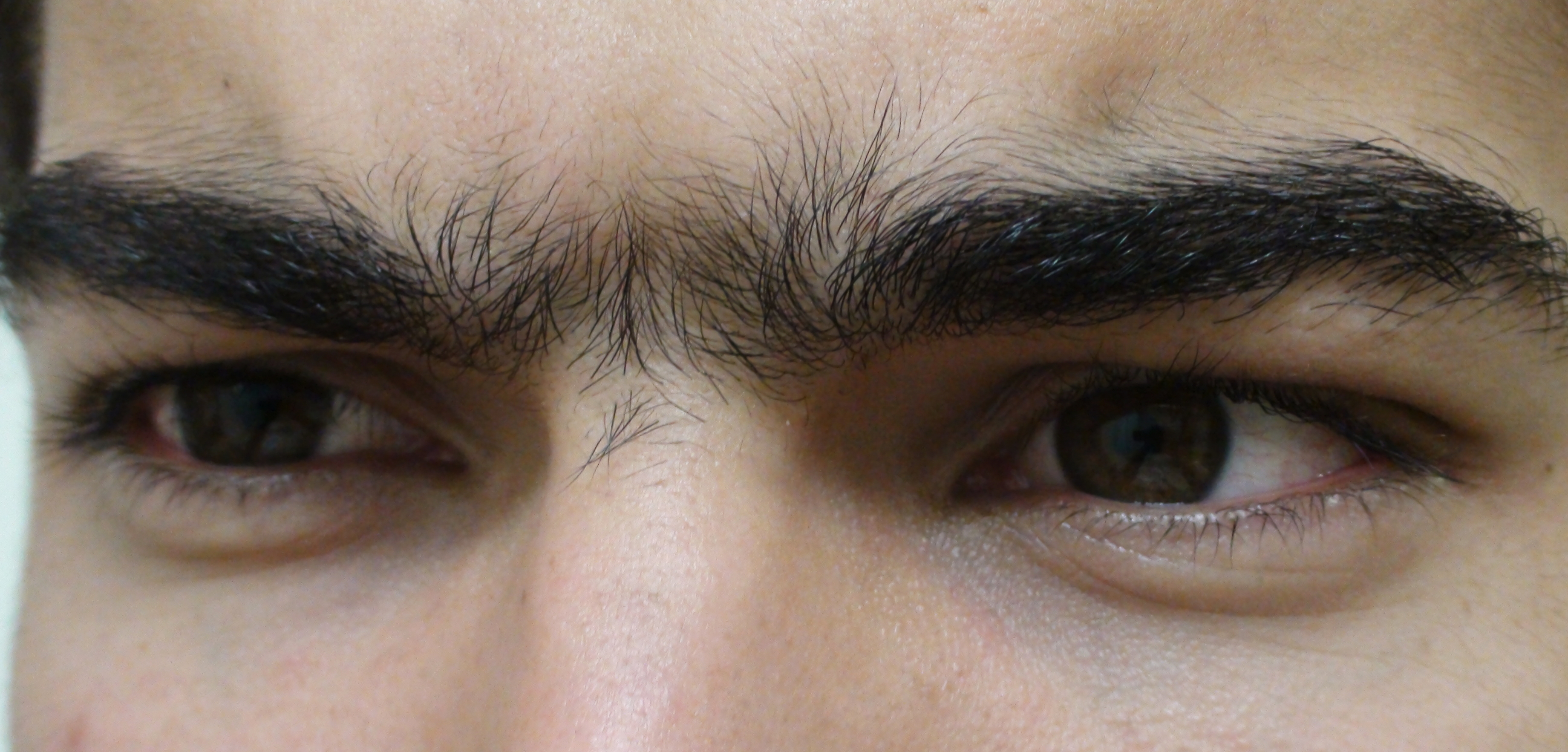 Unibrow_Close_Up.jpg