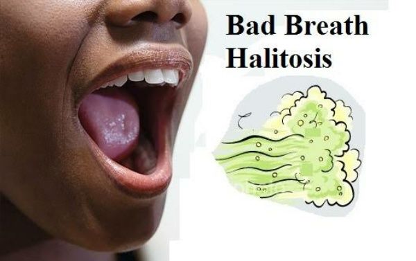 MOUTH ODOUR AND ITS TREATMENT Steemit