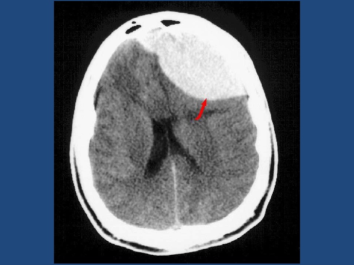 acv-neuroimagenes-10-728.jpg