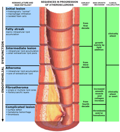 800px-Endo_dysfunction_Athero.png