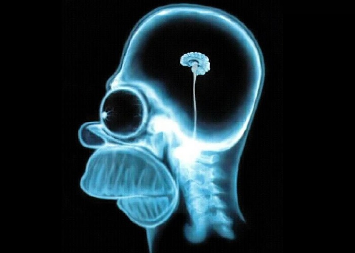 Homer-Brain.jpg