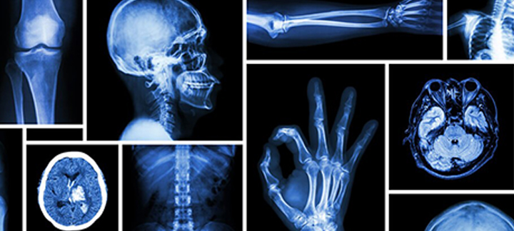 Radiology 1 Main Graphic 720 x 324.jpg