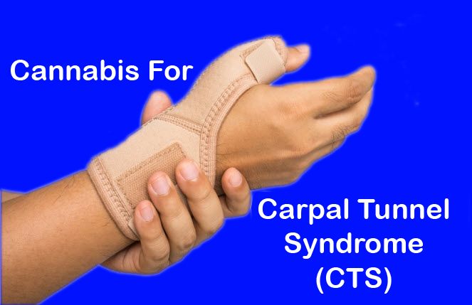 Carpal Tunnel Syndrome 2.jpg