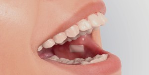 Transmucosal Drug Delivery.jpg