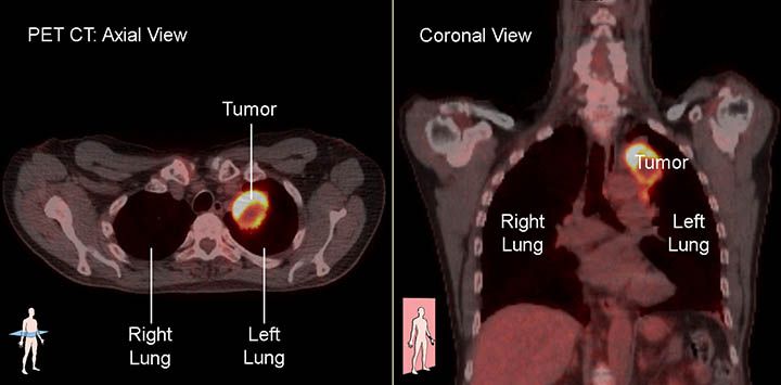 PET-CT.jpg