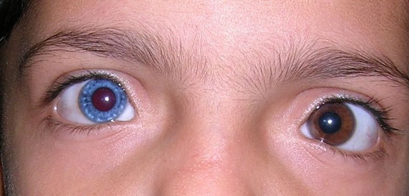 heterochromia.jpg