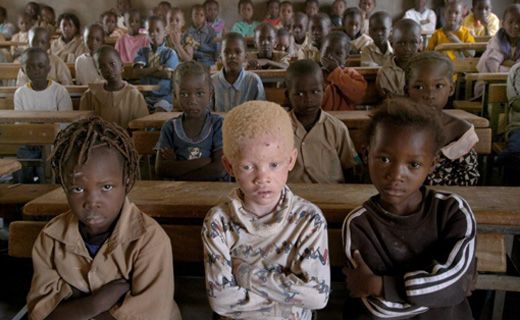 Albinos-Teaser_0.jpg