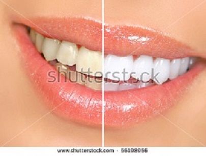 pixteeth.jpg