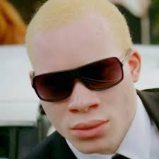 dark glasses albino.jpg