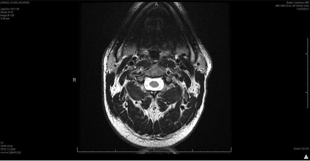 cervical 5.jpg