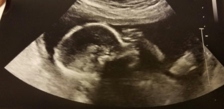 realultrasound_fotor.jpg