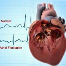 Global Cardiac Rhythm Management Device Mark.jpg