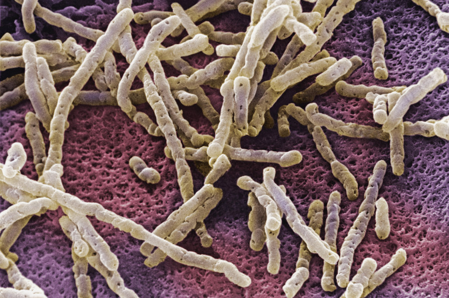 bacteria_slide-6091dcabe34ec831d6b0e62776bc6994ca0d6f47-s900-c85.jpeg.jpg