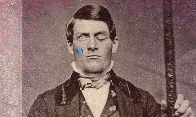 Phineas-Gage.png