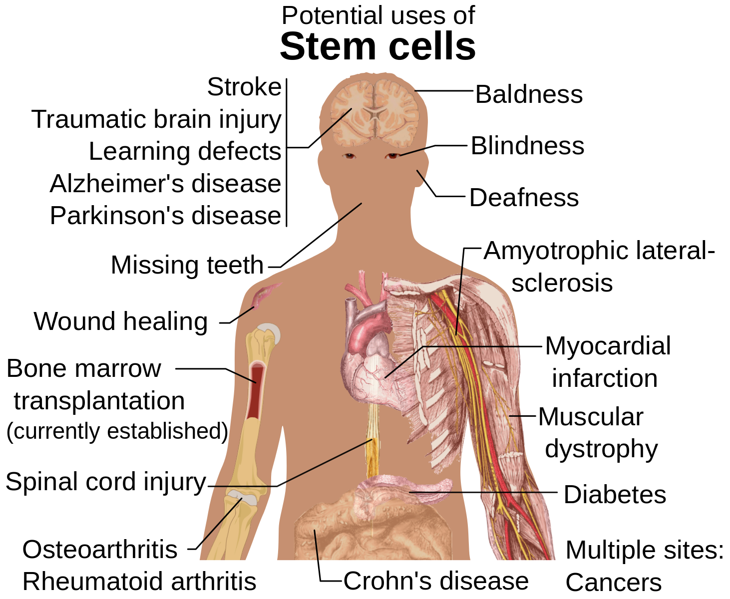 Stem_cell_treatments.svg.png