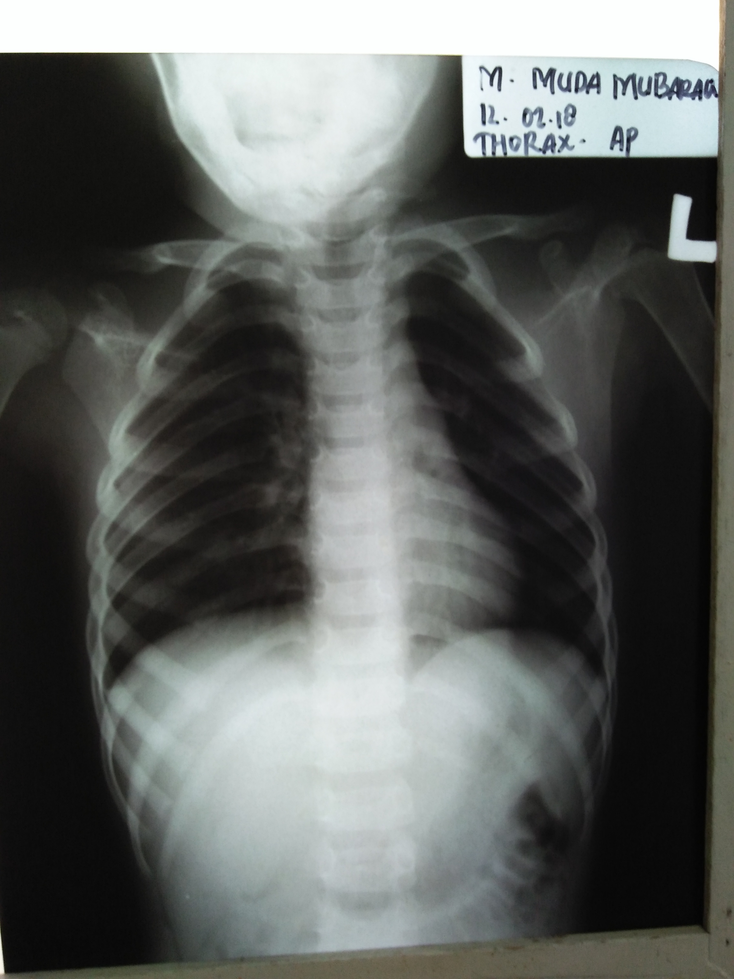 IMG20180212083355.jpg