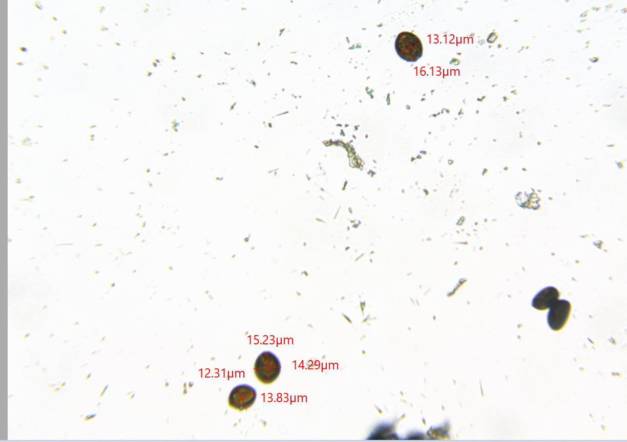 Spores with measurements.png