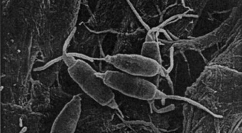 Pestalotiopsis-microspora-hongocomeplastico.jpg
