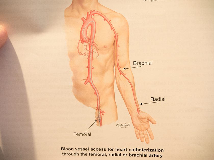 femoral.jpg