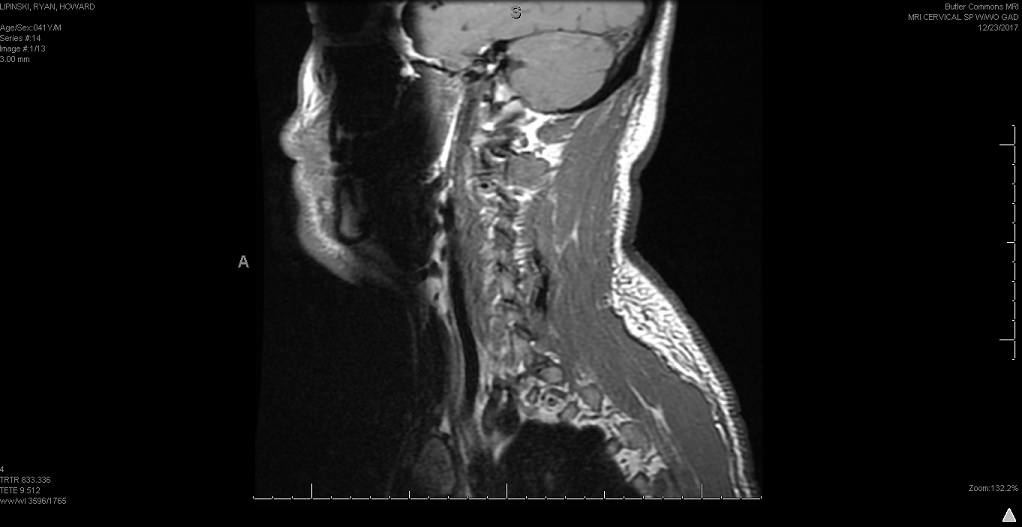 cervical 3.jpg