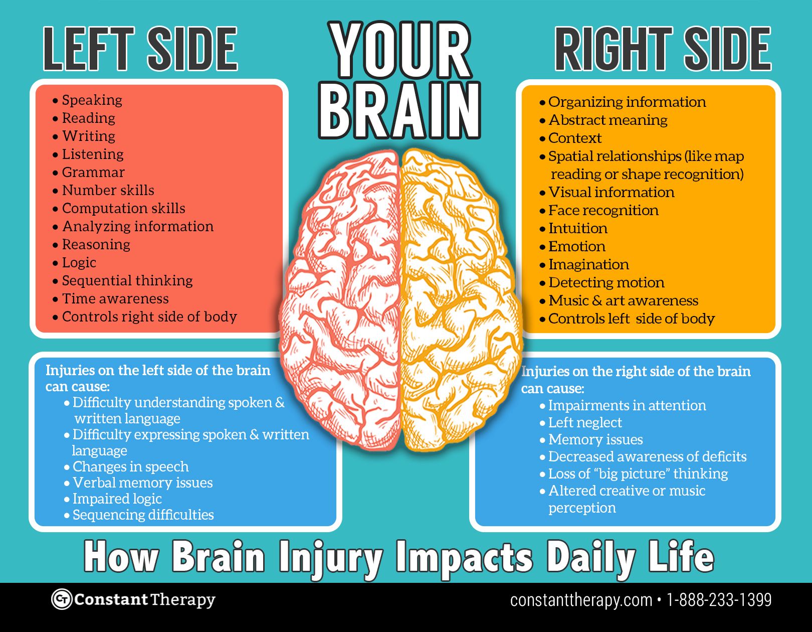 Left Brain vs. Right Brain Dominance: The Surprising Truth