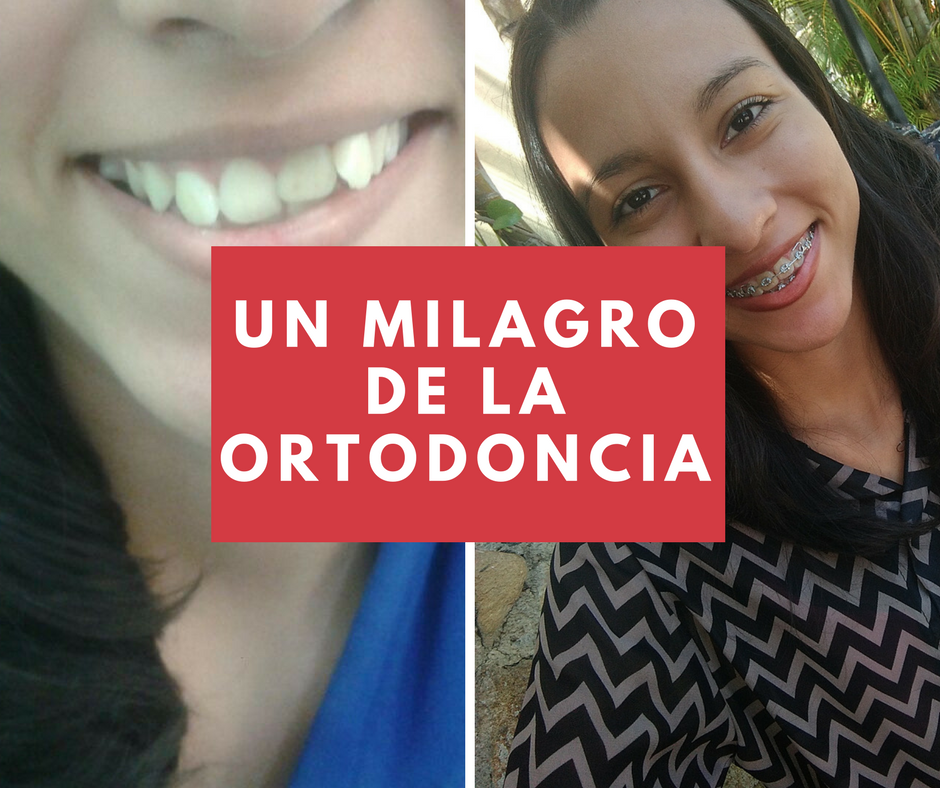 Un milagro de la ortodoncia.png