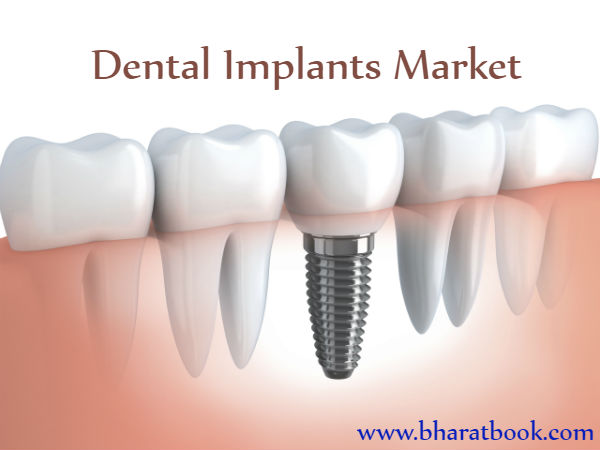 Dental Implants Market.jpg