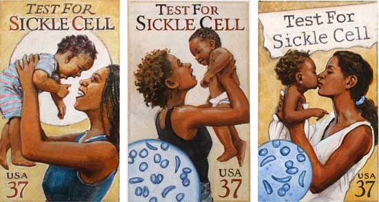 2a1d9-african_americans_sickle_cell_anemia.jpg