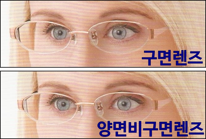 ìë©´ë¹êµ¬ë©´ ë ì¦ì ëí ì´ë¯¸ì§ ê²ìê²°ê³¼