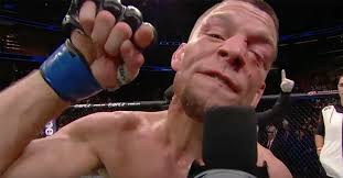 Nate diaz.jpg