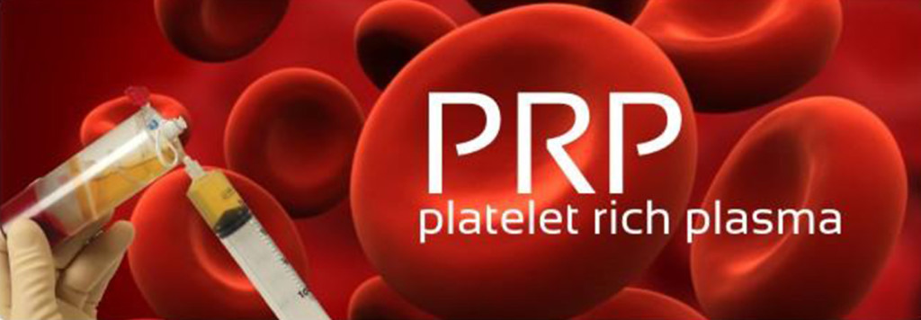 Platelet Rich Plasma.jpg