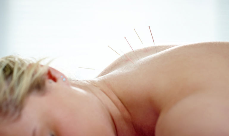 acupuncture-help-strengthen-pelvic-floor.jpg