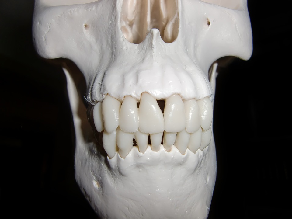 dental cyst