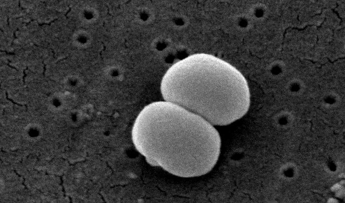 Staphylococcus_epidermidis_lores.jpg