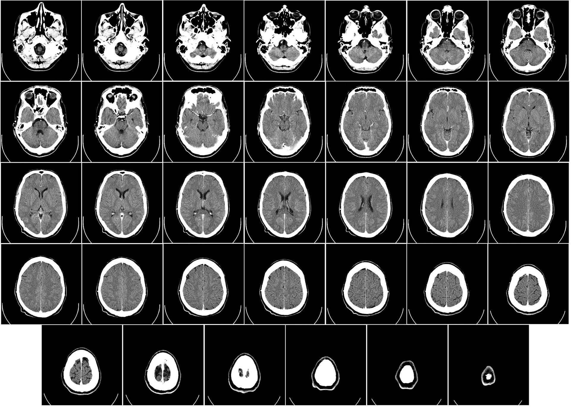 computer-tomography-62942_1920.jpg