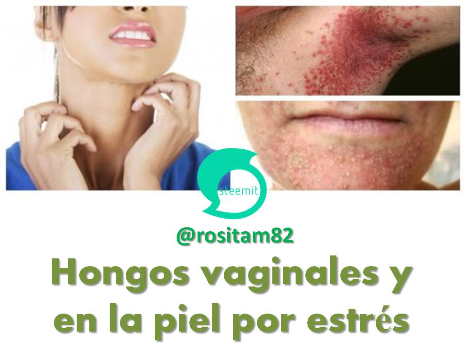 hongos genitales mujer fotos