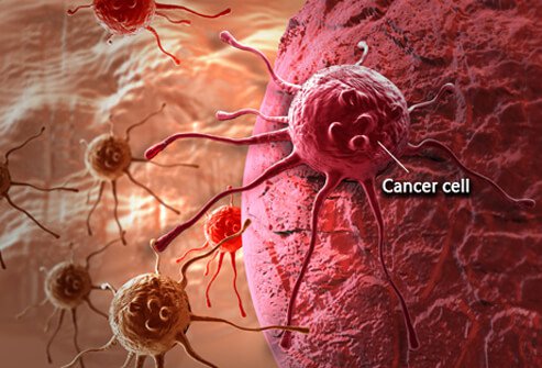 cancer-101-s1-what-is-cancer-cell origin.jpg