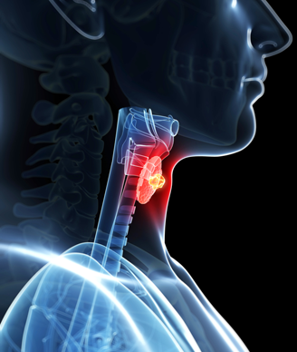 thyroid-cancer-Sebastian-Kaulitzki-ss-328.png