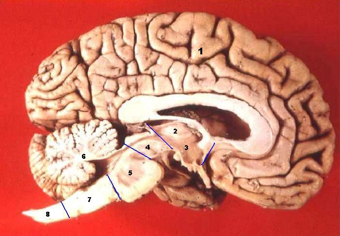 Human_brain_midsagittal_cut_description.JPG