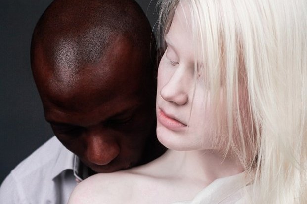 Секс с альбиноской