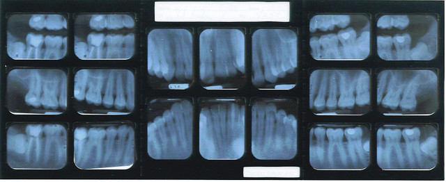 teeth xray.jpg