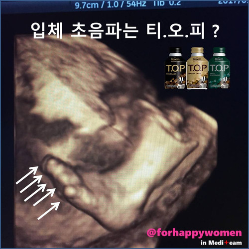 입체초음파.jpg