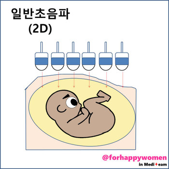 일반초음파.jpg
