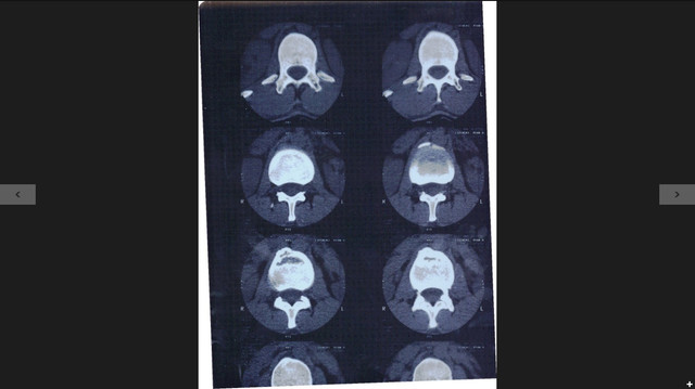 MRI Spine 2.jpg