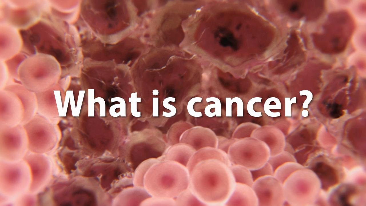 I am cancer. Causes of Cancer.