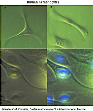Human keratinocytes3 ManatYesbol, Zhansaia, Gaziza Aiatbekovna 4.0.jpg