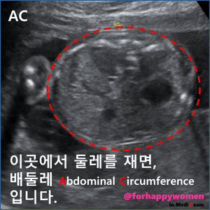 슬라이드5.GIF